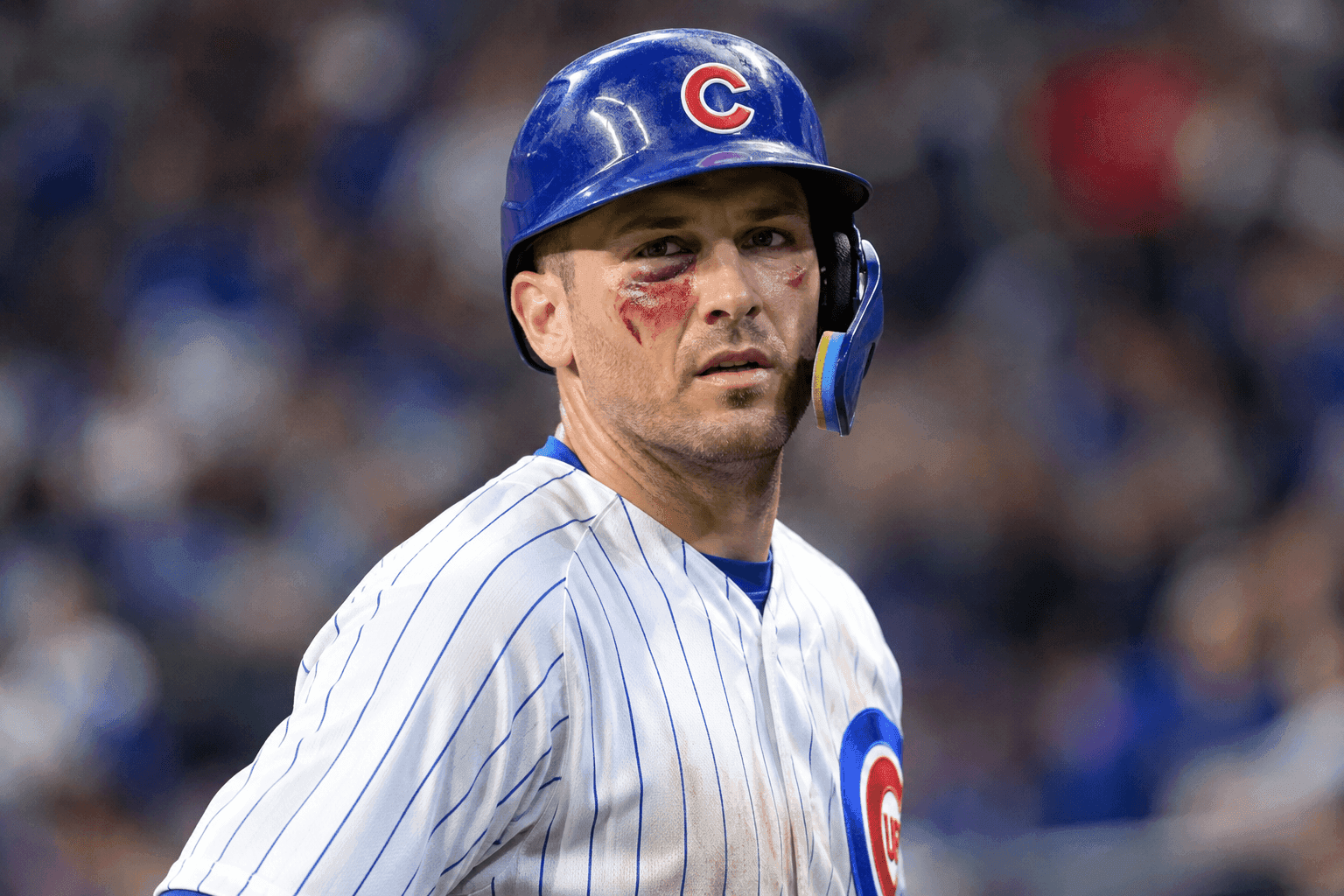 Editorial sports image for Alex Bregman Takes a Foul Ball to the Face, Somehow Avoids Surgery